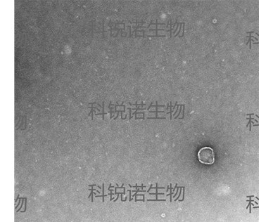   什么是外泌體