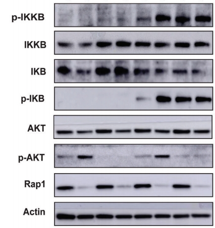 Western blot 檢測