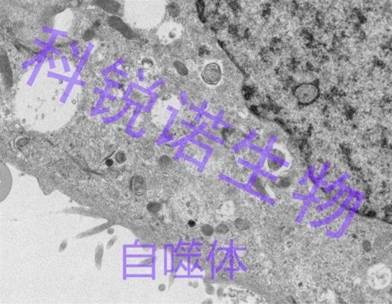 自噬體