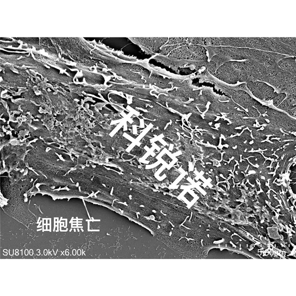 細胞焦亡